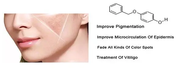 monobenzone for skin monobenzone for skin