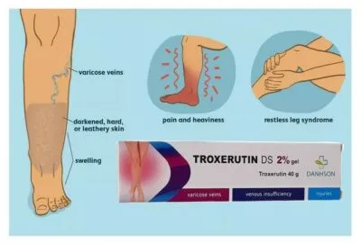 How Does Troxerutin Help With Varicose Veins?