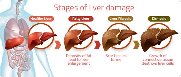 TUDCA ,UDCA for liver TUDCA ,UDCA for liver