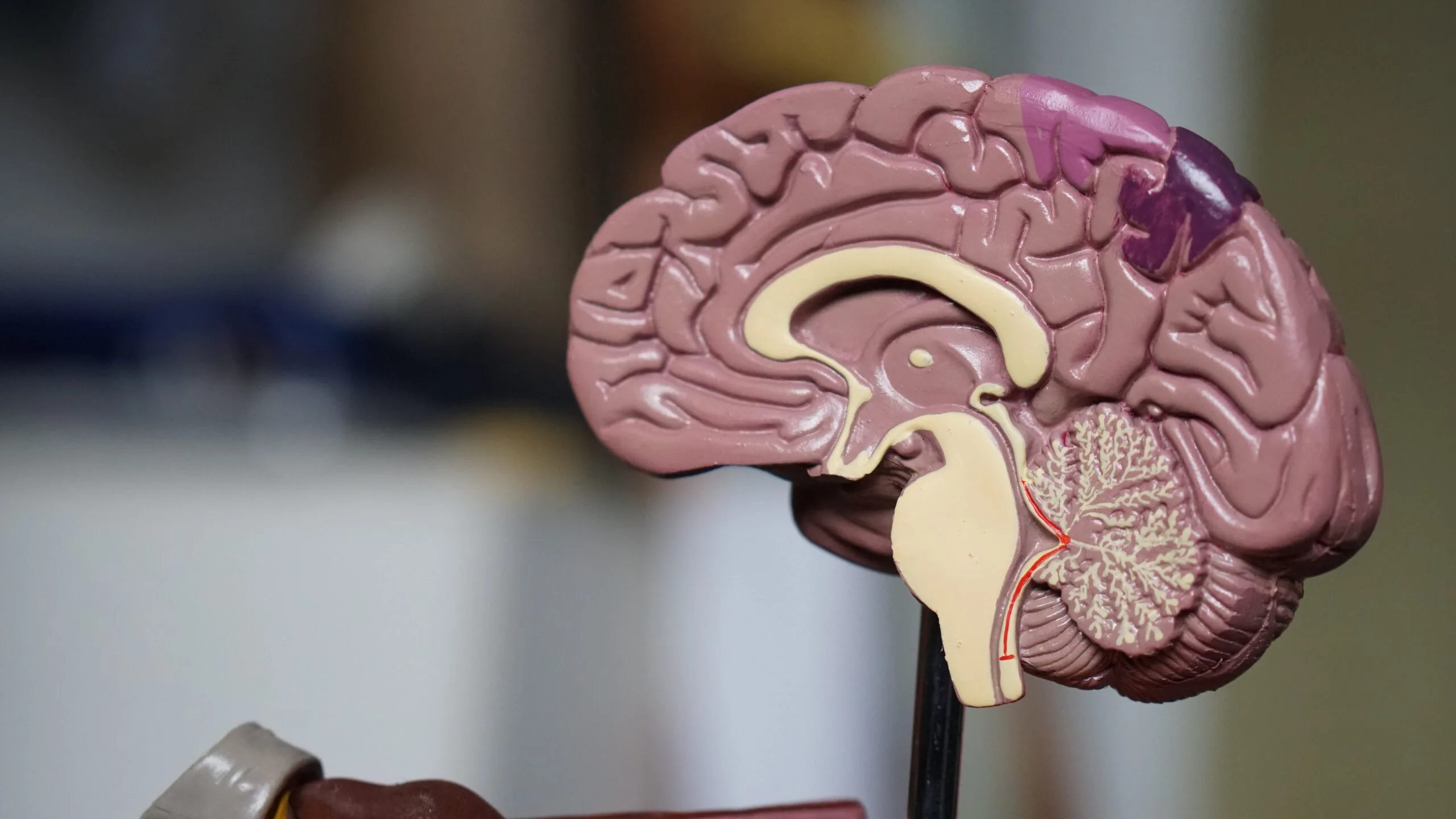 Magnesium L-Threonate For Brain Magnesium L-Threonate For Brain