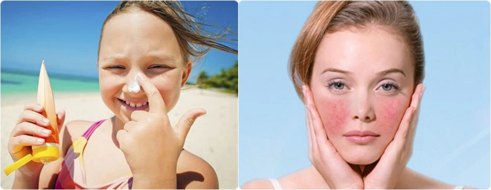 Troxerutin skin benefits Troxerutin skin benefits