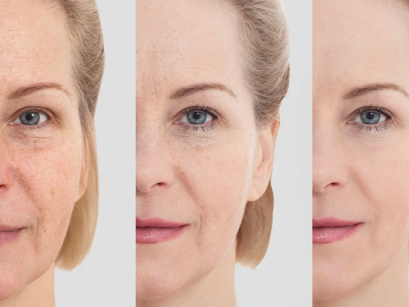 Important anti-aging effects of CoQ10