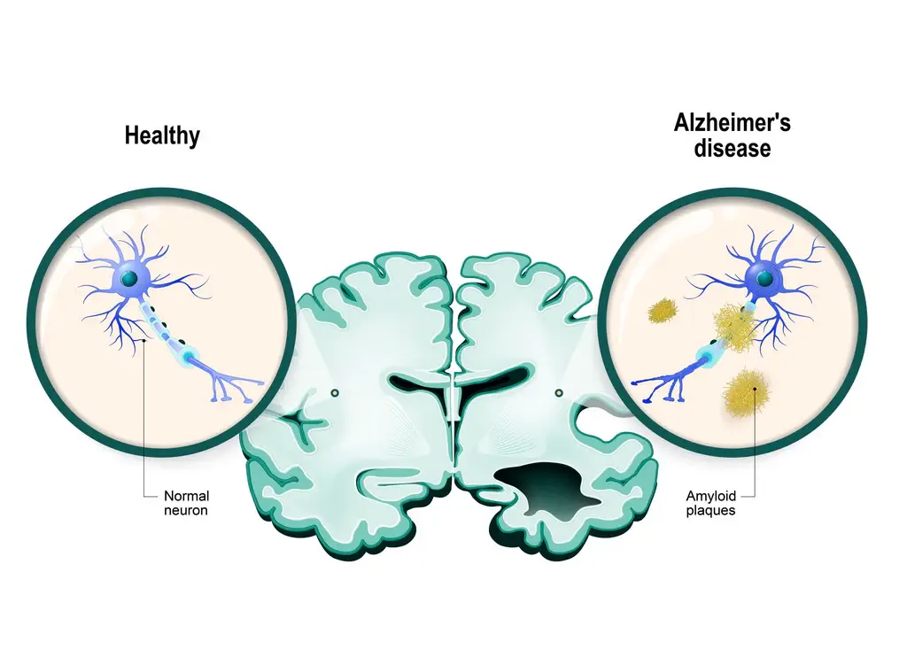 Alpha GPC Choline Supplements:alpha gpc brain benefits