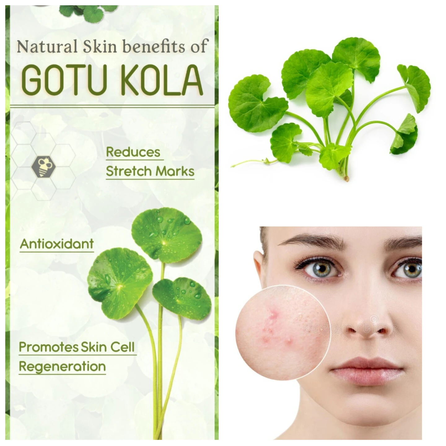 Centella Asiatica Extract Benefits For Skin Centella Asiatica Extract Benefits For Skin