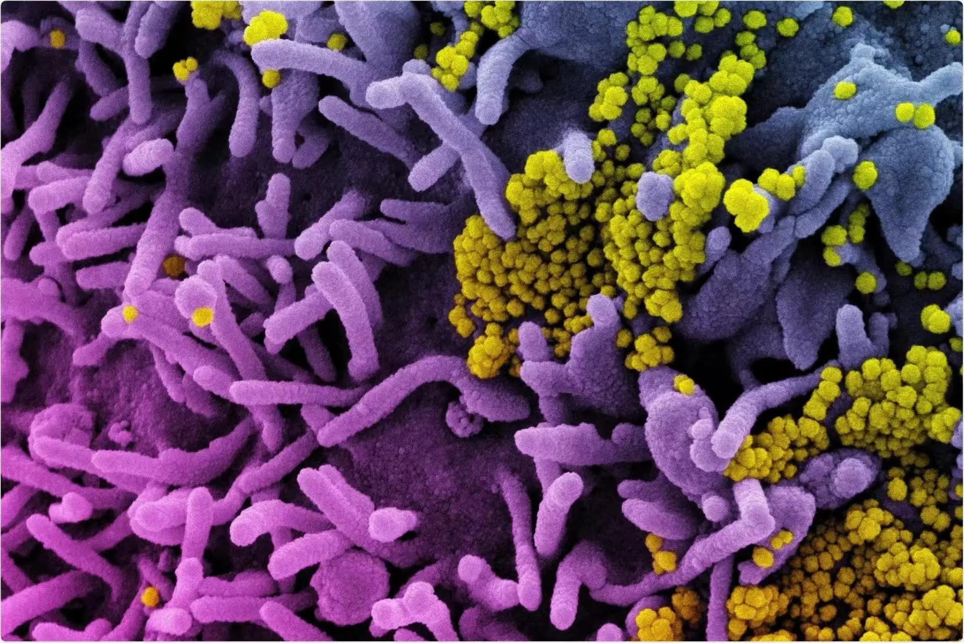rutin for antiviral 