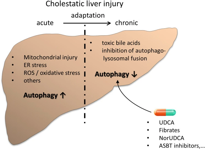 UDCA for Cholestatic Liver Diseases UDCA for Cholestatic Liver Diseases