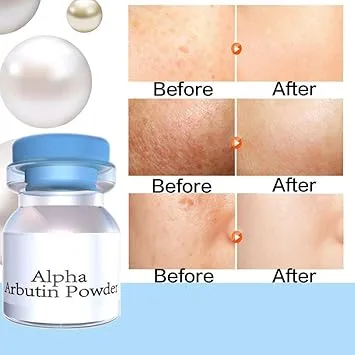  Alpha Arbutin Powder For Skin