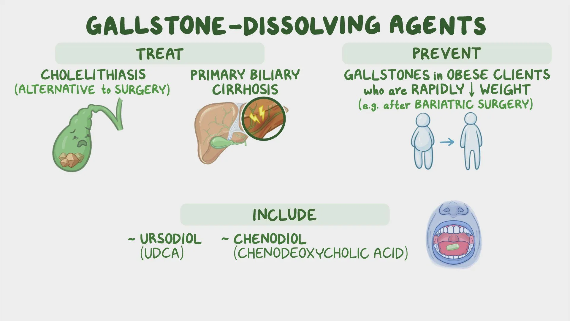 Gallstone-dissolving agents:UDCA Gallstone-dissolving agents:UDCA