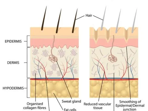 Spermidine – for hair Spermidine – for hair